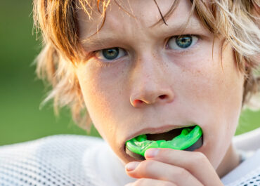 Does My Child Need A Mouthguard?